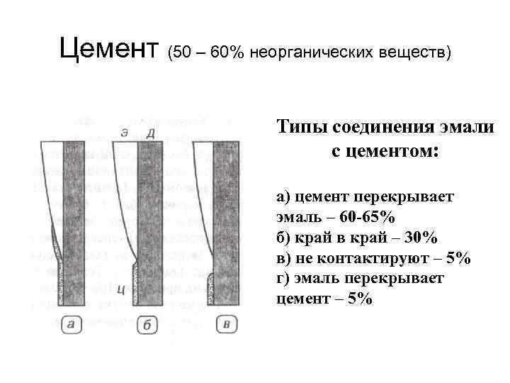 Цемент (50 – 60% неорганических веществ) Типы соединения эмали с цементом: а) цемент перекрывает