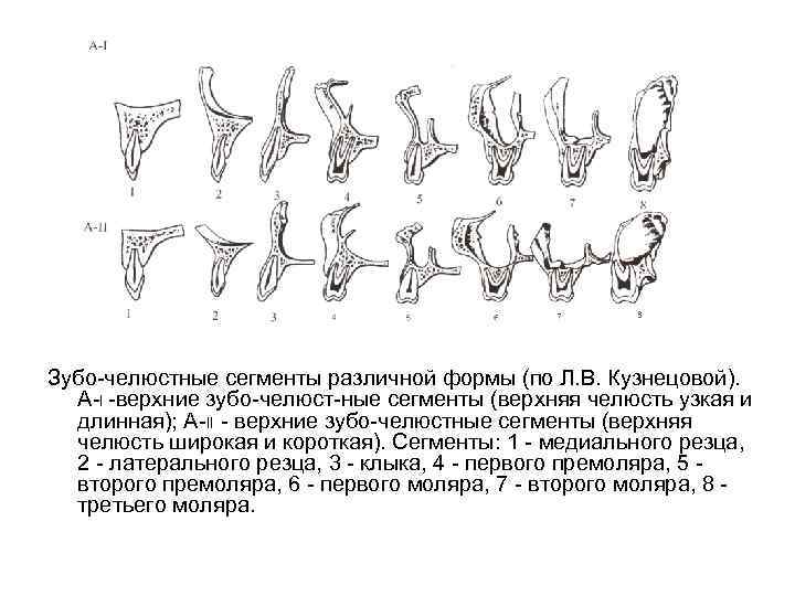 Зубо челюстные сегменты различной формы (по Л. В. Кузнецовой). А I верхние зубо челюст