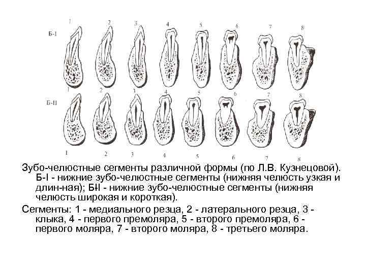 Зубо челюстные сегменты различной формы (по Л. В. Кузнецовой). Б I нижние зубо челюстные