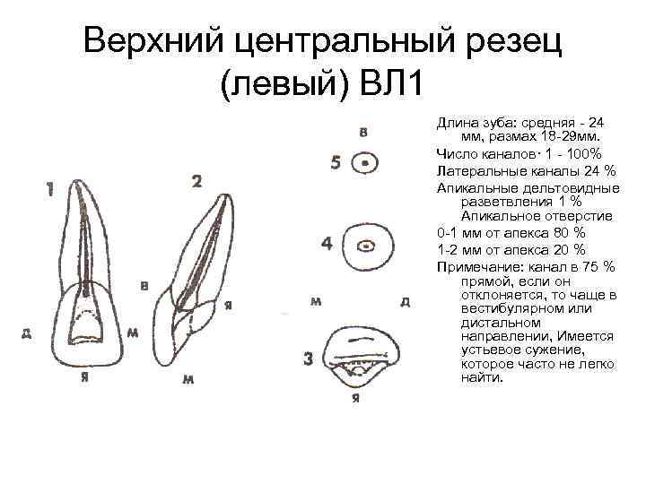 Верхний центральный резец (левый) ВЛ 1 Длина зуба: средняя 24 мм, размах 18 29