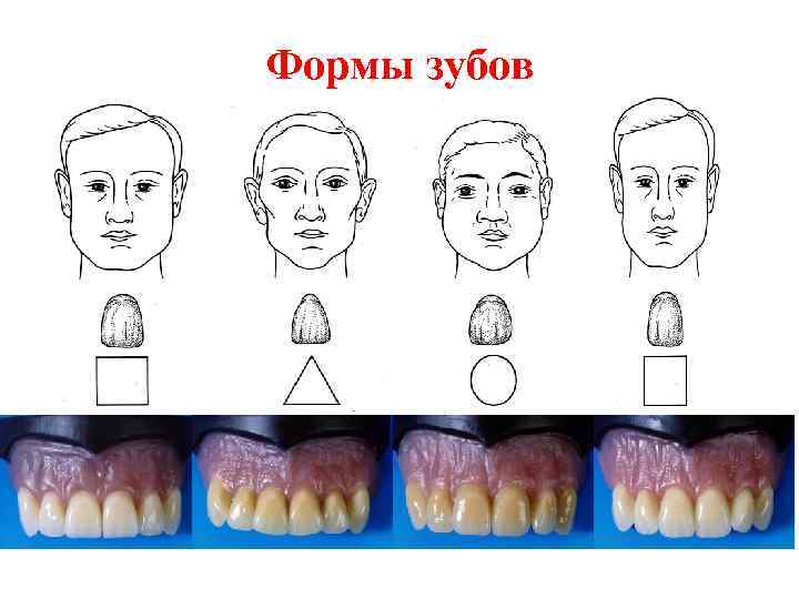 Формы зубов 