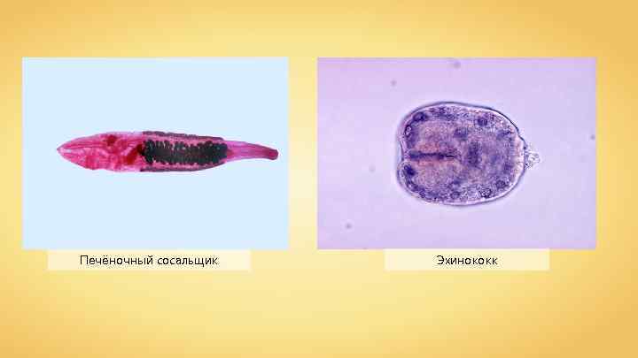 Печёночный сосальщик Эхинококк 