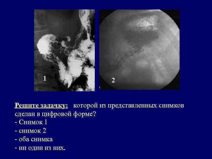1 2 Решите задачку: которой из представленных снимков сделан в цифровой форме? - Снимок