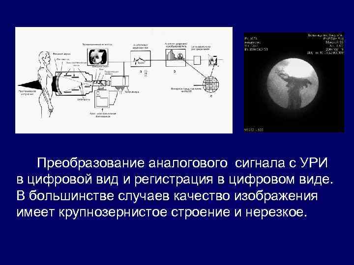 Преобразование аналогового сигнала с УРИ в цифровой вид и регистрация в цифровом виде. В