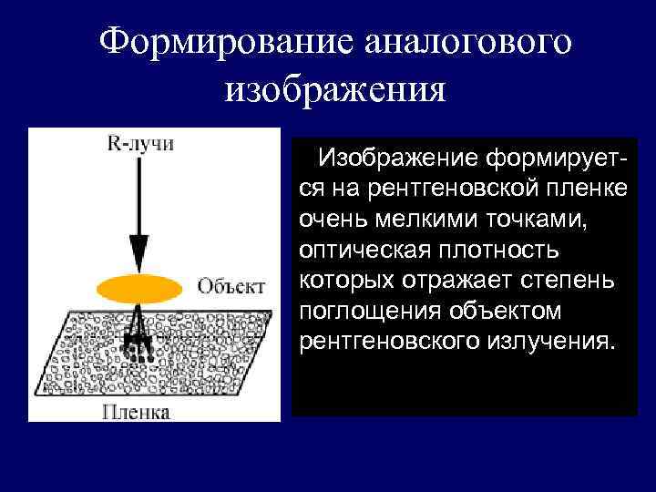 Формирование аналогового изображения Изображение формируется на рентгеновской пленке очень мелкими точками, оптическая плотность которых