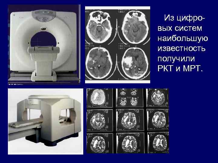 Из цифровых систем наибольшую известность получили РКТ и МРТ. 