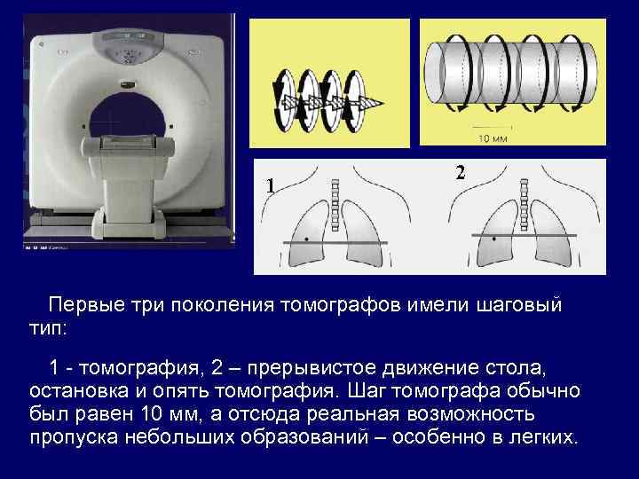 1 2 Первые три поколения томографов имели шаговый тип: 1 - томография, 2 –
