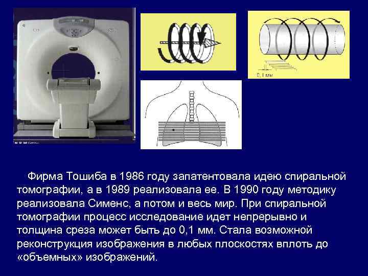 Фирма Тошиба в 1986 году запатентовала идею спиральной томографии, а в 1989 реализовала ее.
