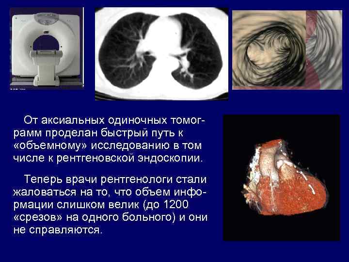 От аксиальных одиночных томограмм проделан быстрый путь к «объемному» исследованию в том числе к