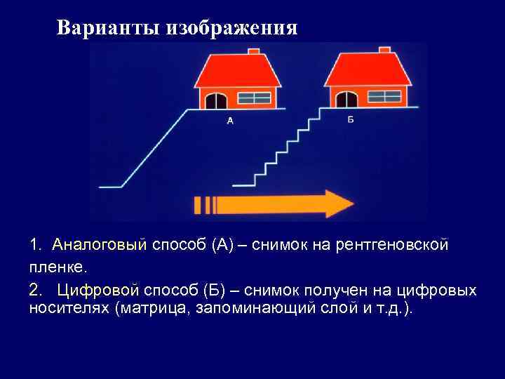 Варианты изображения 1. Аналоговый способ (А) – снимок на рентгеновской пленке. 2. Цифровой способ