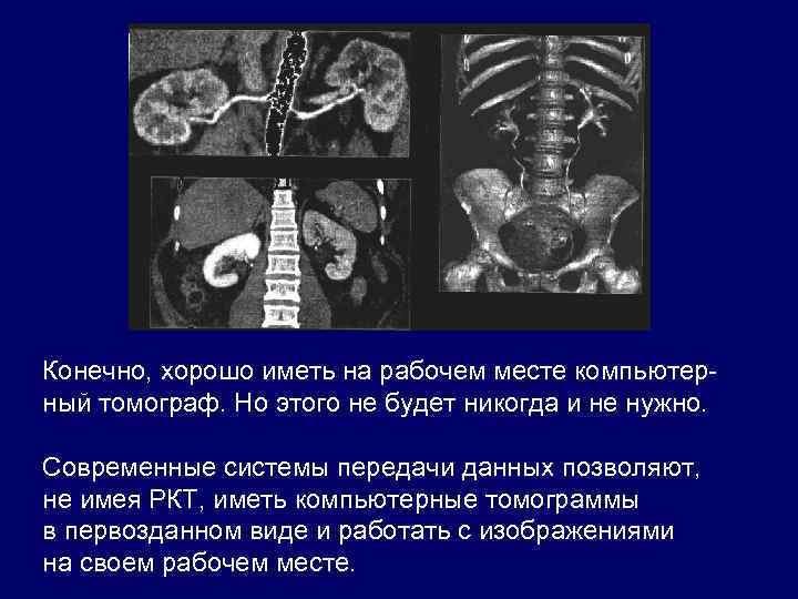 Конечно, хорошо иметь на рабочем месте компьютерный томограф. Но этого не будет никогда и