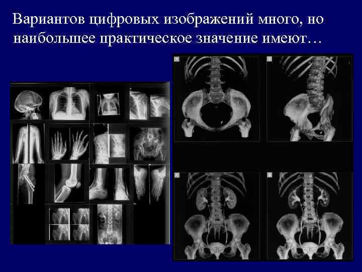 Вариантов цифровых изображений много, но наибольшее практическое значение имеют… 