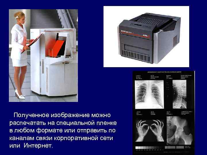 Полученное изображение можно распечатать на специальной пленке в любом формате или отправить по каналам