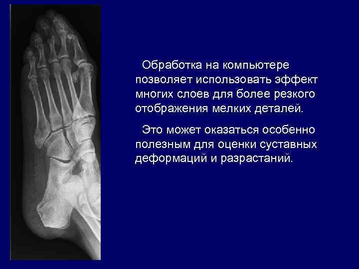 Обработка на компьютере позволяет использовать эффект многих слоев для более резкого отображения мелких деталей.