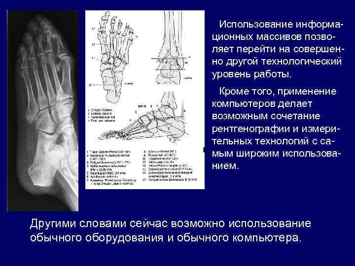Использование информационных массивов позволяет перейти на совершенно другой технологический уровень работы. Кроме того, применение