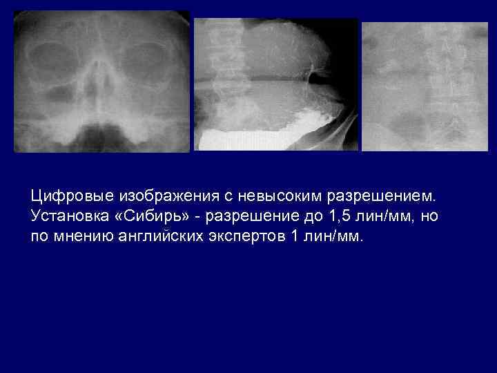 Цифровые изображения с невысоким разрешением. Установка «Сибирь» - разрешение до 1, 5 лин/мм, но