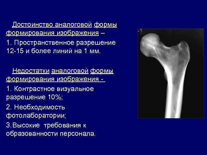 Достоинство аналоговой формы формирования изображения – 1. Пространственное разрешение 12 -15 и более линий