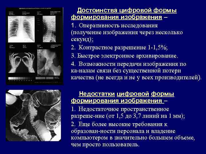 Обработка рентгеновского изображения