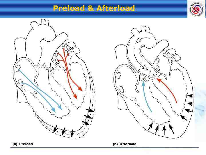 Preload & Afterload 