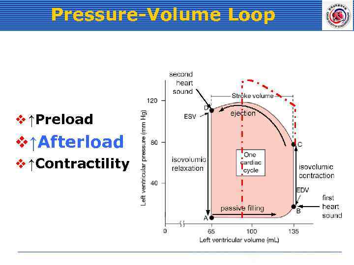 Pressure-Volume Loop v ↑Preload v↑Afterload v ↑Contractility 