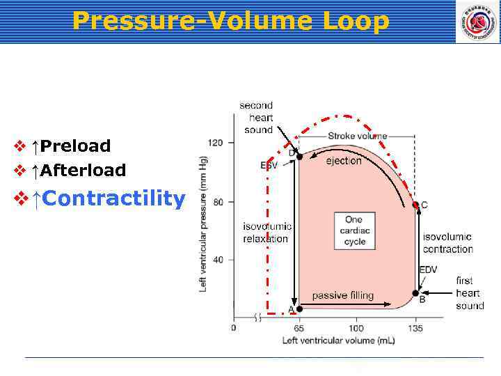 Pressure-Volume Loop v ↑Preload v ↑Afterload v ↑Contractility 