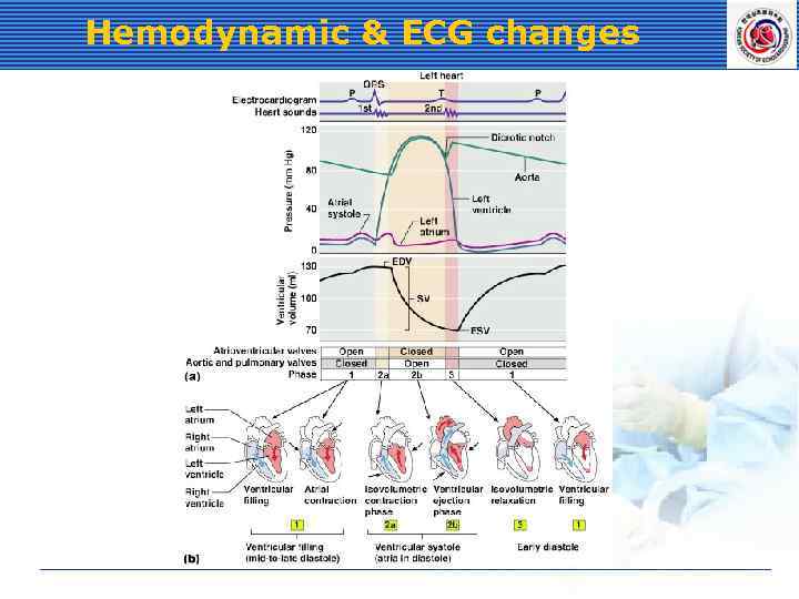Hemodynamic & ECG changes 