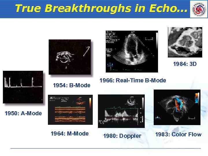 True Breakthroughs in Echo. . . 1984: 3 D 1954: B-Mode 1966: Real-Time B-Mode