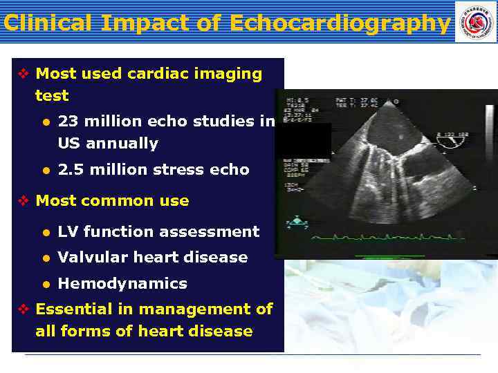 Clinical Impact of Echocardiography v Most used cardiac imaging test l 23 million echo