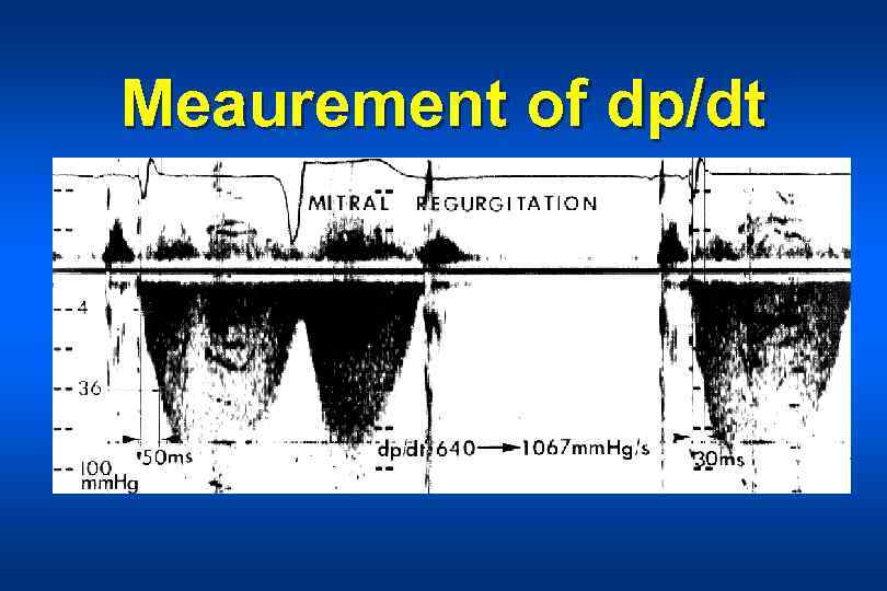 Meaurement of dp/dt 