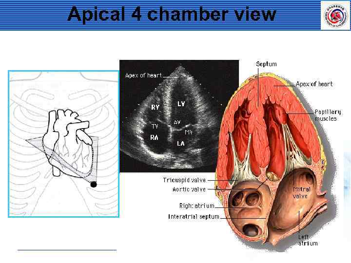Apical 4 chamber view 