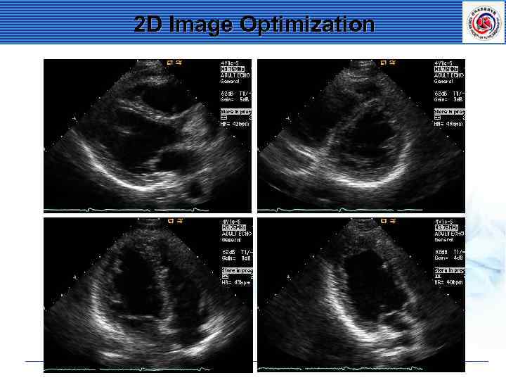 2 D Image Optimization 