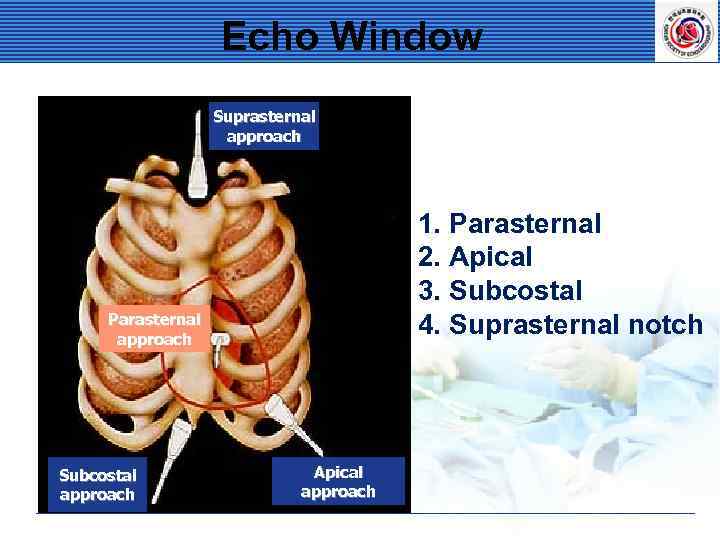 Echo Window Suprasternal approach 1. Parasternal 2. Apical 3. Subcostal 4. Suprasternal notch Parasternal