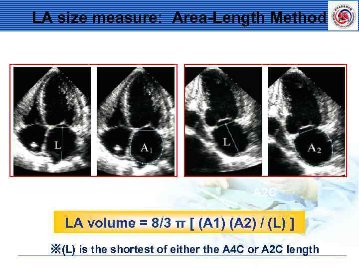 LA size measure: Area-Length Method A 4 C A 2 C LA volume =