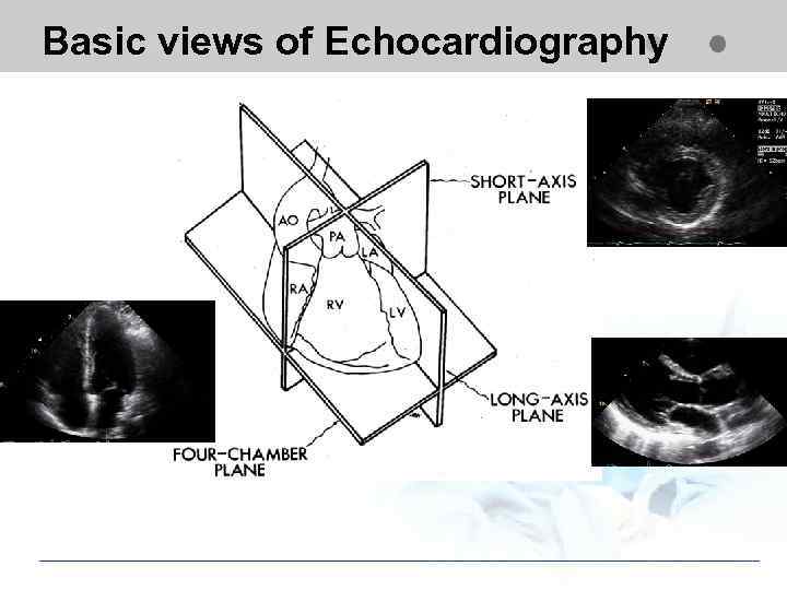 Basic views of Echocardiography 