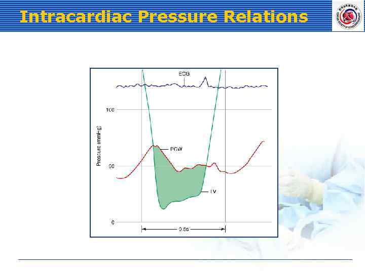 Intracardiac Pressure Relations 