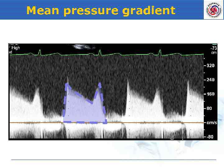 Mean pressure gradient 