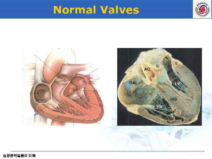 Normal Valves 심장판막질환의 이해 