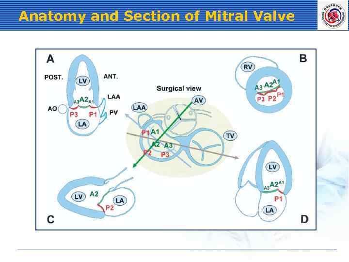 Anatomy and Section of Mitral Valve 