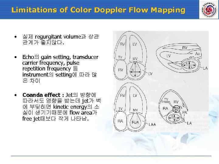 Limitations of Color Doppler Flow Mapping • 실제 regurgitant volume과 상관 관계가 좋지않다. •