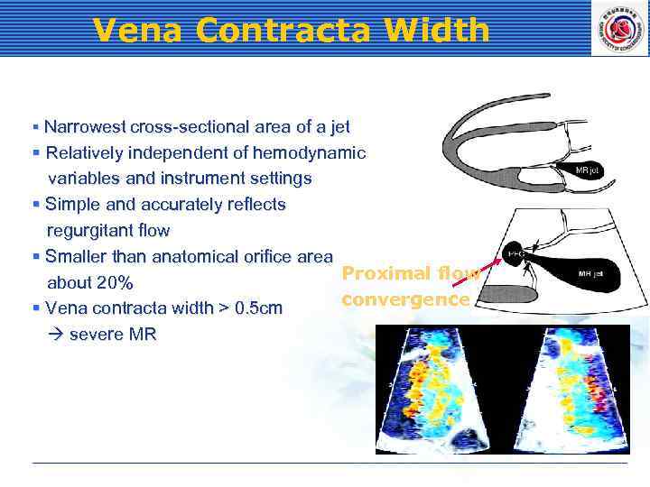 Vena Contracta Width § Narrowest cross-sectional area of a jet § Relatively independent of