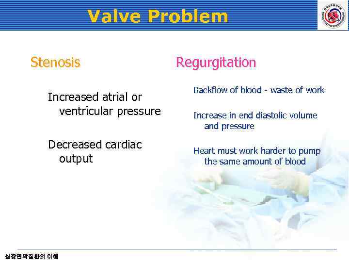 Valve Problem Stenosis Increased atrial or ventricular pressure Decreased cardiac output 심장판막질환의 이해 Regurgitation