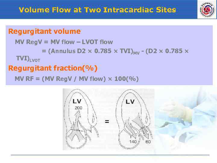 Volume Flow at Two Intracardiac Sites Regurgitant volume MV Reg. V = MV flow