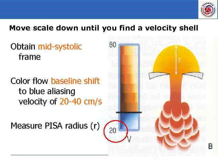 Move scale down until you find a velocity shell Obtain mid-systolic frame Color flow