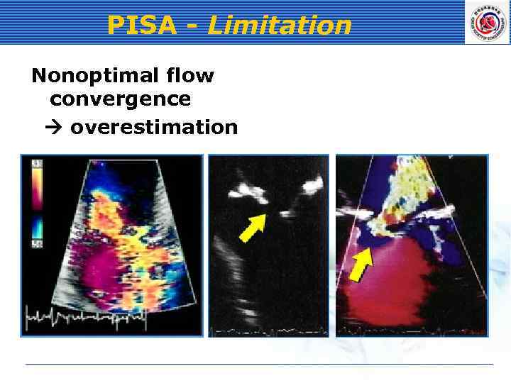 PISA - Limitation Nonoptimal flow convergence overestimation 