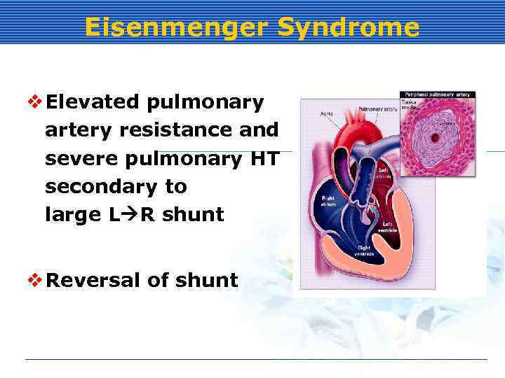 Eisenmenger Syndrome v Elevated pulmonary artery resistance and severe pulmonary HT secondary to large