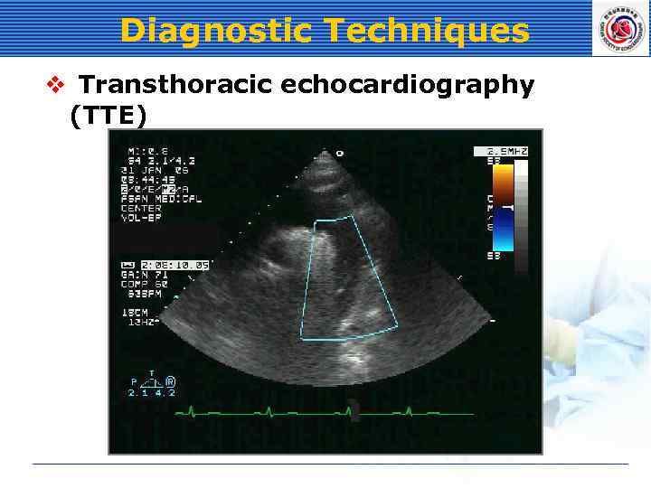 Diagnostic Techniques v Transthoracic echocardiography (TTE) 