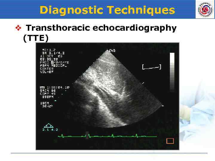 Diagnostic Techniques v Transthoracic echocardiography (TTE) 