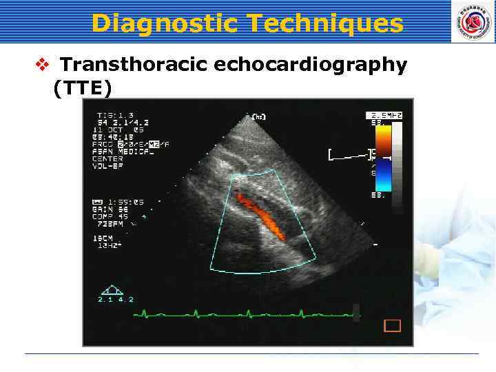 Diagnostic Techniques v Transthoracic echocardiography (TTE) 