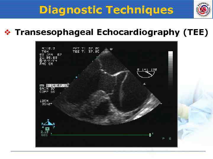 Diagnostic Techniques v Transesophageal Echocardiography (TEE) 