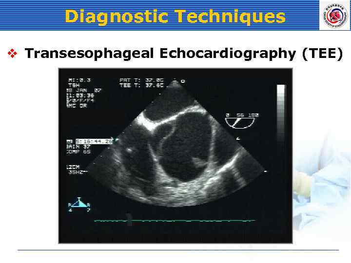 Diagnostic Techniques v Transesophageal Echocardiography (TEE) 